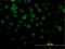 Cyclin-D-binding Myb-like transcription factor 1 antibody, LS-C133617, Lifespan Biosciences, Immunofluorescence image 