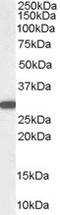 NAD(P)H Quinone Dehydrogenase 1 antibody, STJ70143, St John