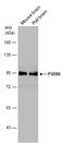 Discs Large MAGUK Scaffold Protein 4 antibody, GTX133167, GeneTex, Western Blot image 