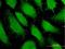 PDZ Domain Containing Ring Finger 4 antibody, H00029951-B01P, Novus Biologicals, Immunofluorescence image 