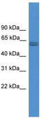Pyruvate Kinase M1/2 antibody, TA344601, Origene, Western Blot image 