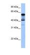 Terminal Nucleotidyltransferase 5C antibody, NBP1-57697, Novus Biologicals, Western Blot image 