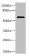 Phospholipase A2 Group IVC antibody, LS-C676270, Lifespan Biosciences, Western Blot image 