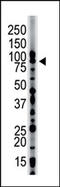 Hepatocyte Growth Factor-Regulated Tyrosine Kinase Substrate antibody, AP12065PU-N, Origene, Western Blot image 