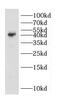 CD72 Molecule antibody, FNab01498, FineTest, Western Blot image 
