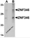 Zinc Finger Protein 346 antibody, 6209, ProSci Inc, Western Blot image 