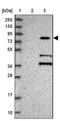 Kelch Repeat And BTB Domain Containing 7 antibody, NBP1-92040, Novus Biologicals, Western Blot image 