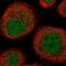 UEV And Lactate/Malate Dehyrogenase Domains antibody, NBP1-92561, Novus Biologicals, Immunocytochemistry image 