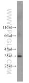 Fc Fragment Of IgG Receptor And Transporter antibody, 16190-1-AP, Proteintech Group, Western Blot image 
