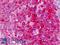 Bruton Tyrosine Kinase antibody, LS-B8736, Lifespan Biosciences, Immunohistochemistry frozen image 