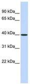 Methionine adenosyltransferase 2 subunit beta antibody, TA342139, Origene, Western Blot image 