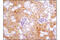 Thymidylate Synthetase antibody, 9045T, Cell Signaling Technology, Immunohistochemistry paraffin image 