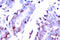 Signal Transducer And Activator Of Transcription 1 antibody, LS-C176216, Lifespan Biosciences, Immunohistochemistry paraffin image 