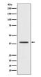 H2A Histone Family Member Y antibody, M04635, Boster Biological Technology, Western Blot image 