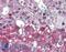 Neurotrophic Receptor Tyrosine Kinase 1 antibody, LS-B2410, Lifespan Biosciences, Immunohistochemistry paraffin image 