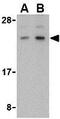 Barrier To Autointegration Factor 1 antibody, GTX16986, GeneTex, Western Blot image 