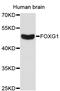 Forkhead Box G1 antibody, STJ114267, St John