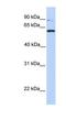 Protein Tyrosine Phosphatase Receptor Type A antibody, NBP1-62456, Novus Biologicals, Western Blot image 
