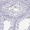 Melanocortin 5 Receptor antibody, HPA042365, Atlas Antibodies, Immunohistochemistry frozen image 