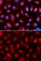 Kinesin Light Chain 1 antibody, GTX54339, GeneTex, Immunofluorescence image 