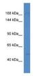 SET Domain Containing 5 antibody, NBP1-74109, Novus Biologicals, Western Blot image 