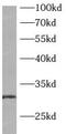 ATPase H+ Transporting V1 Subunit E2 antibody, FNab00723, FineTest, Western Blot image 