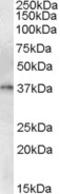 GTP cyclohydrolase I antibody, TA305613, Origene, Western Blot image 