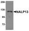 NLR Family Pyrin Domain Containing 13 antibody, PA5-21028, Invitrogen Antibodies, Western Blot image 