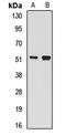 Bleomycin Hydrolase antibody, LS-C667715, Lifespan Biosciences, Western Blot image 