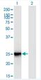 Folliculogenesis Specific BHLH Transcription Factor antibody, H00344018-M03-100ug, Novus Biologicals, Western Blot image 