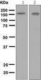 ATPase Copper Transporting Beta antibody, ab124973, Abcam, Western Blot image 