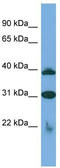 Solute Carrier Family 1 Member 6 antibody, TA333952, Origene, Western Blot image 
