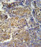 Killer cell immunoglobulin-like receptor 2DS2 antibody, LS-C165531, Lifespan Biosciences, Immunohistochemistry frozen image 
