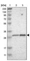 Proteasome 26S Subunit, Non-ATPase 8 antibody, PA5-52329, Invitrogen Antibodies, Western Blot image 