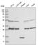 Clathrin Light Chain B antibody, HPA036458, Atlas Antibodies, Western Blot image 