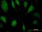 Eukaryotic Translation Elongation Factor 1 Delta antibody, H00001936-M04, Novus Biologicals, Immunofluorescence image 