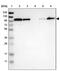 Striatin antibody, PA5-53576, Invitrogen Antibodies, Western Blot image 