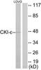 Casein Kinase 1 Epsilon antibody, TA312479, Origene, Western Blot image 