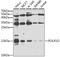 DNA-directed RNA polymerases I and III subunit RPAC2 antibody, A8021, ABclonal Technology, Western Blot image 