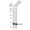 Fatty Acid Binding Protein 2 antibody, GTX03192, GeneTex, Western Blot image 