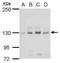 L1 Cell Adhesion Molecule antibody, GTX129010, GeneTex, Western Blot image 