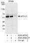 Serine palmitoyltransferase 1 antibody, A303-408A, Bethyl Labs, Immunoprecipitation image 