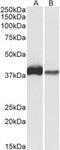 Capping Actin Protein, Gelsolin Like antibody, MBS423456, MyBioSource, Western Blot image 