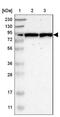 Polypeptide N-Acetylgalactosaminyltransferase 8 antibody, NBP1-81848, Novus Biologicals, Western Blot image 