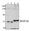 Dual specificity protein phosphatase 16 antibody, A06264, Boster Biological Technology, Western Blot image 
