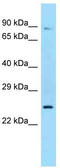 Sex Hormone Binding Globulin antibody, TA343267, Origene, Western Blot image 