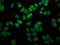 UPF3B Regulator Of Nonsense Mediated MRNA Decay antibody, LS-C682336, Lifespan Biosciences, Immunofluorescence image 