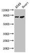 Phosphofructokinase, Muscle antibody, CSB-PA017822LA01HU, Cusabio, Western Blot image 
