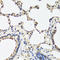 Regenerating Family Member 3 Alpha antibody, LS-C331896, Lifespan Biosciences, Immunohistochemistry paraffin image 
