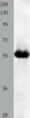 Keratin 4 antibody, TA323032, Origene, Western Blot image 